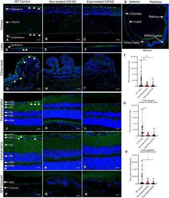 Ergothioneine, a dietary antioxidant improves amyloid beta clearance in the neuroretina of a mouse model of Alzheimer’s disease